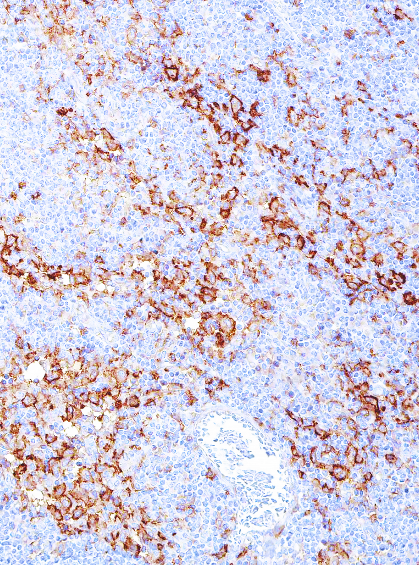 CD14