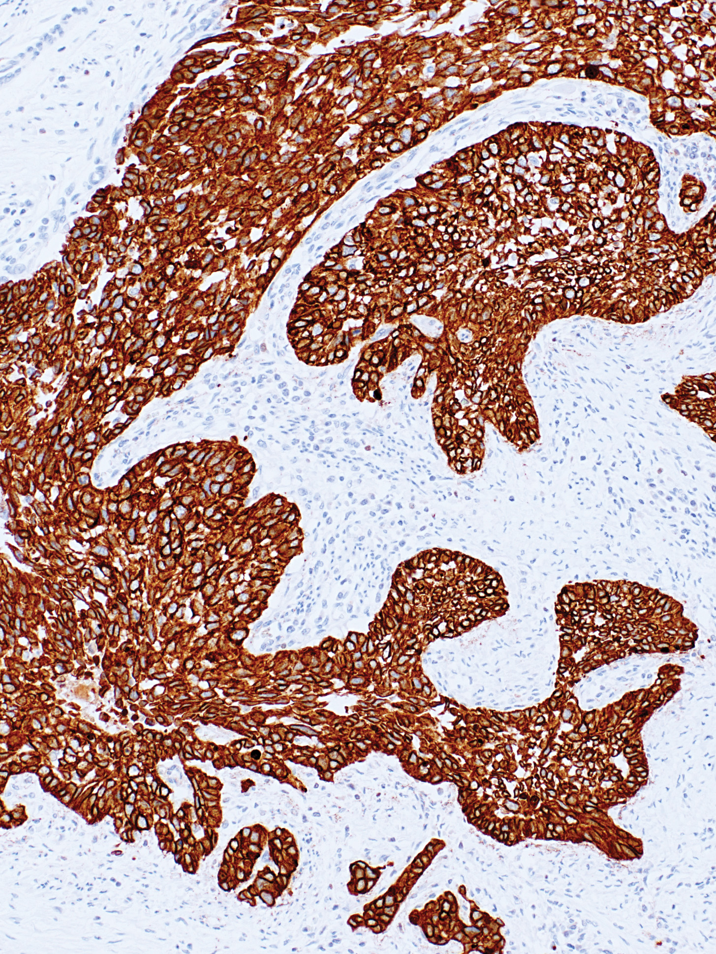 Cytokeratin (AE1/AE3)