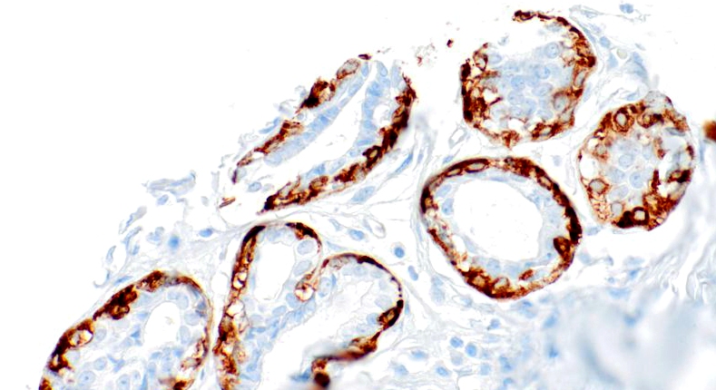 Calponin