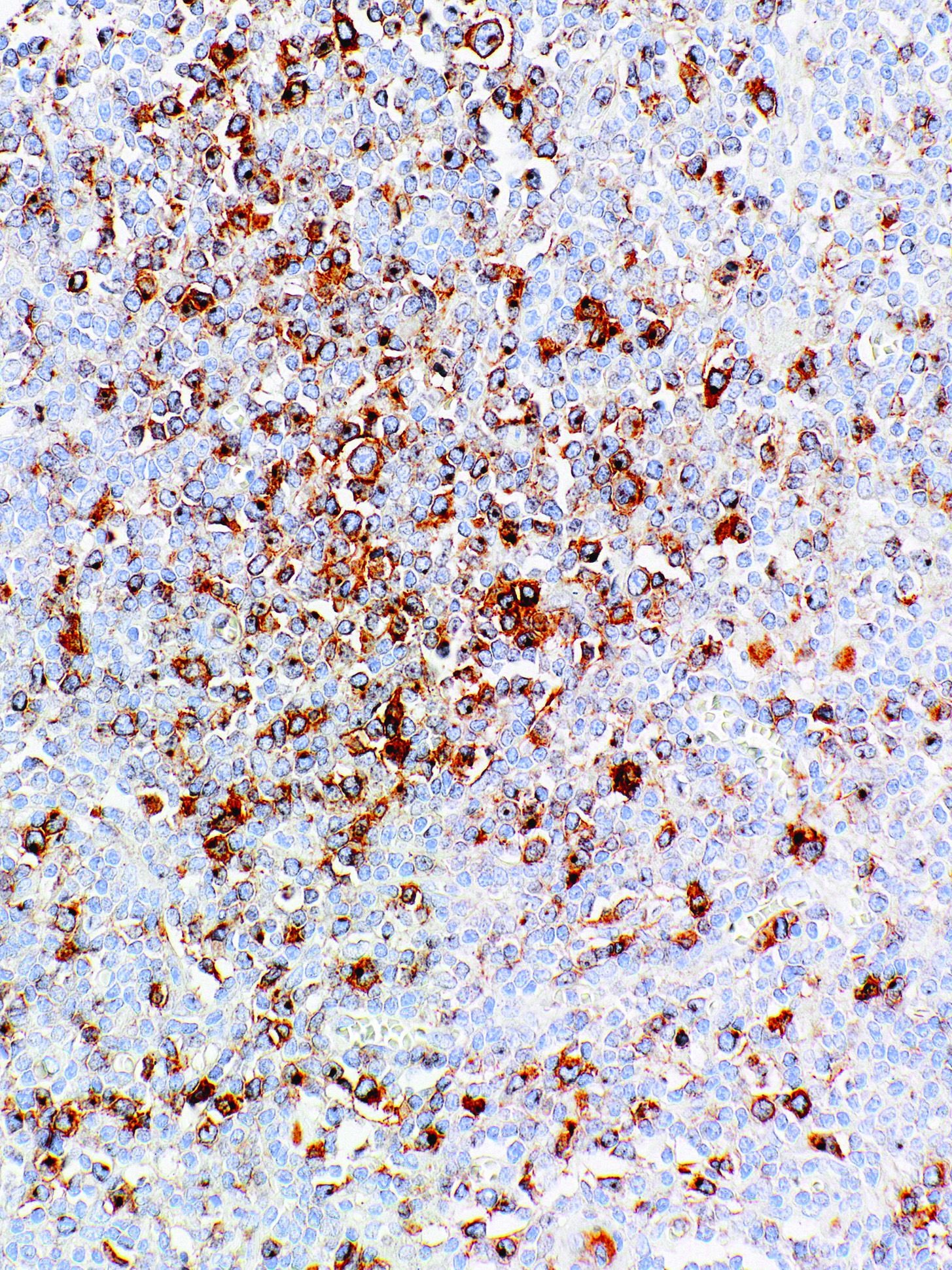 CD30