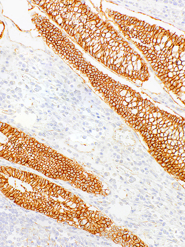 Beta-Catenin