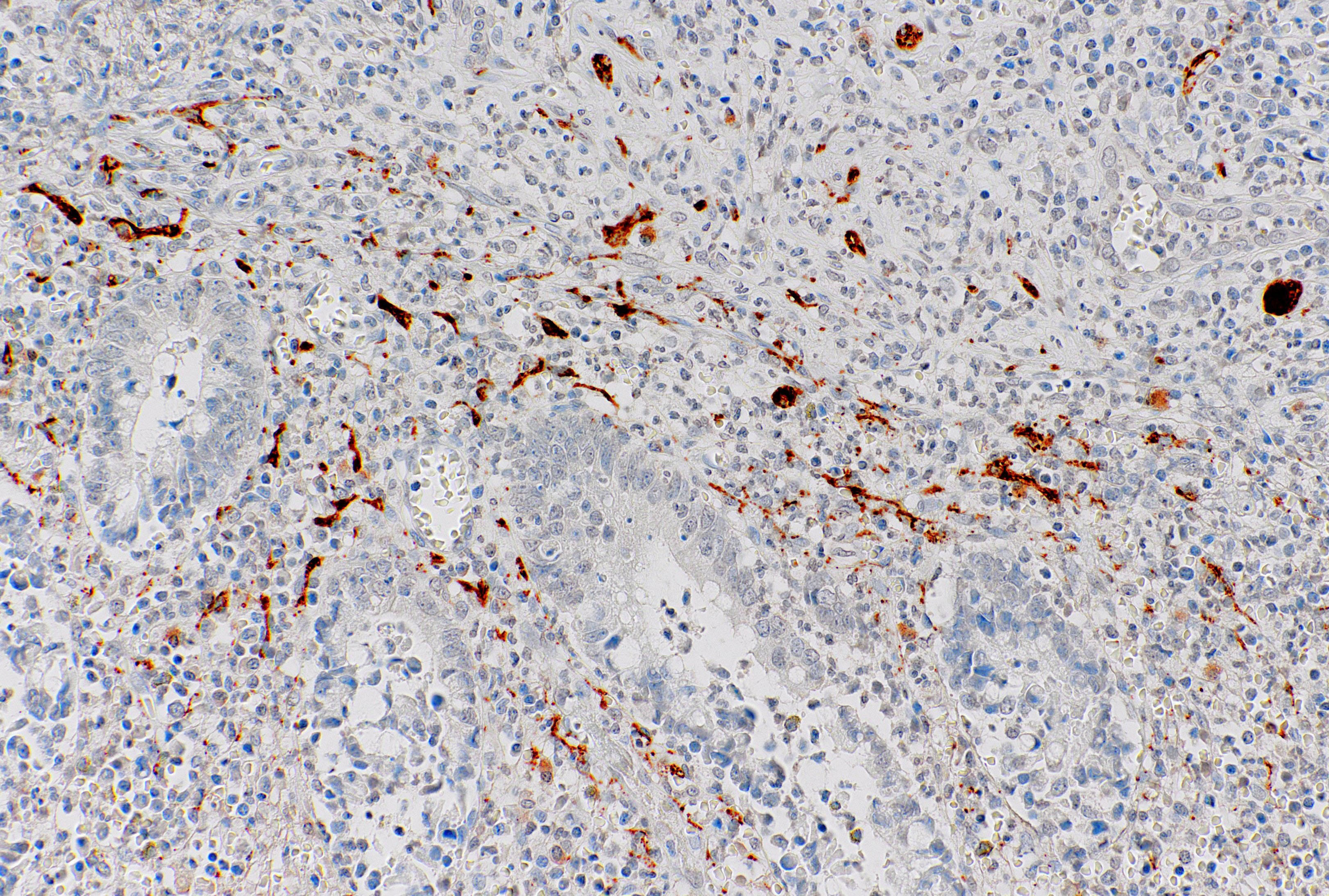 Calretinin
