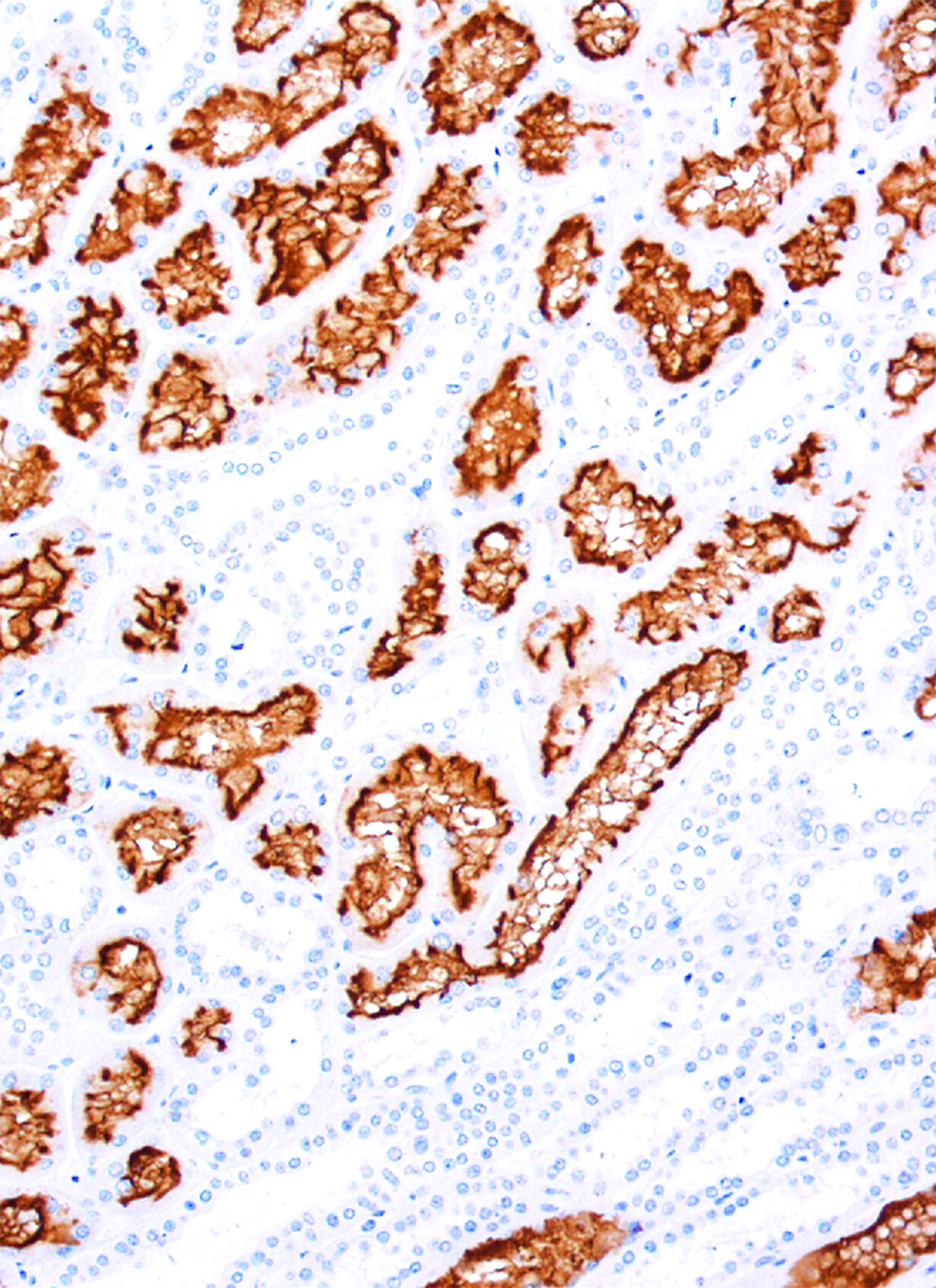 CD10