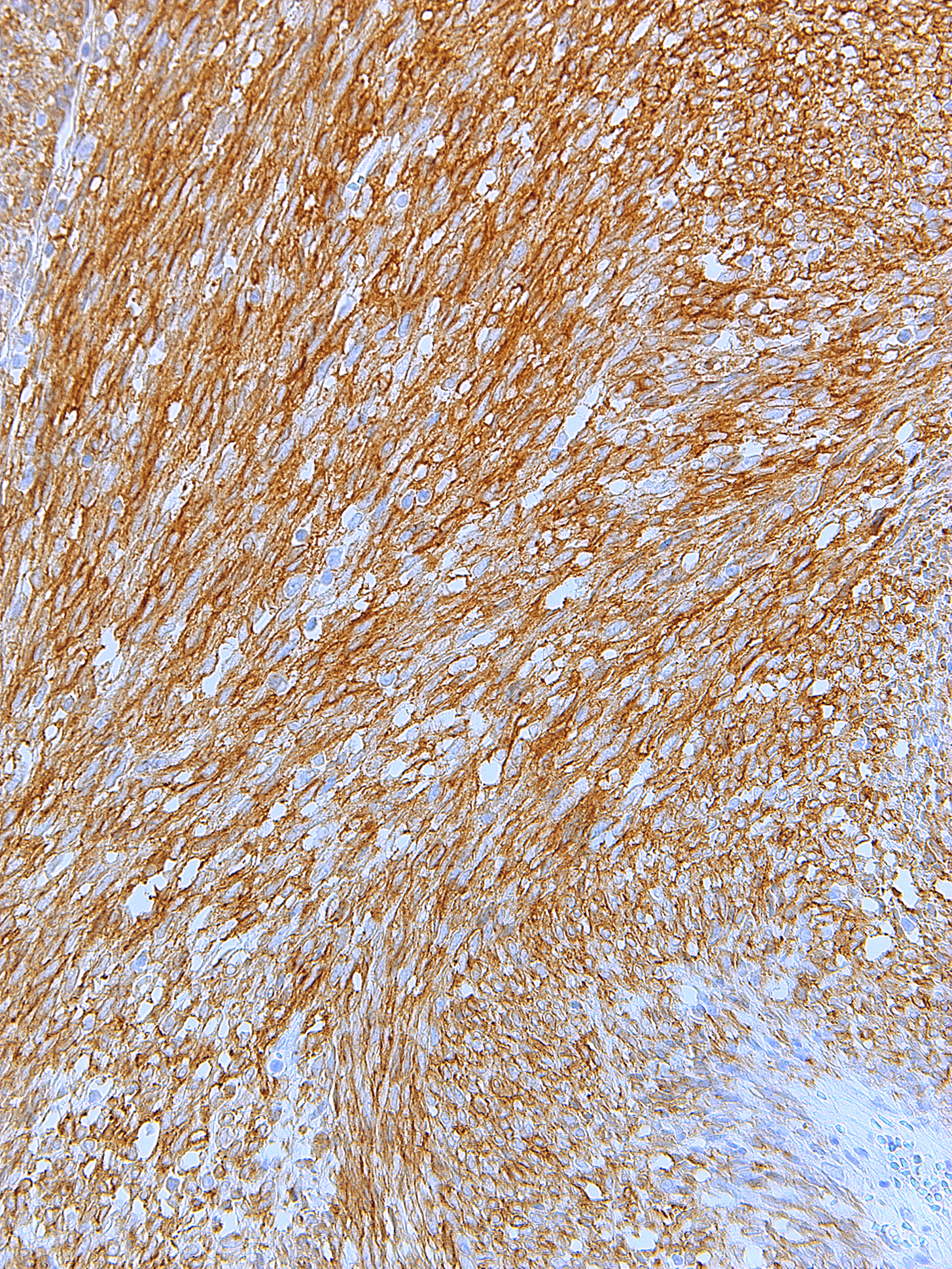 CD117