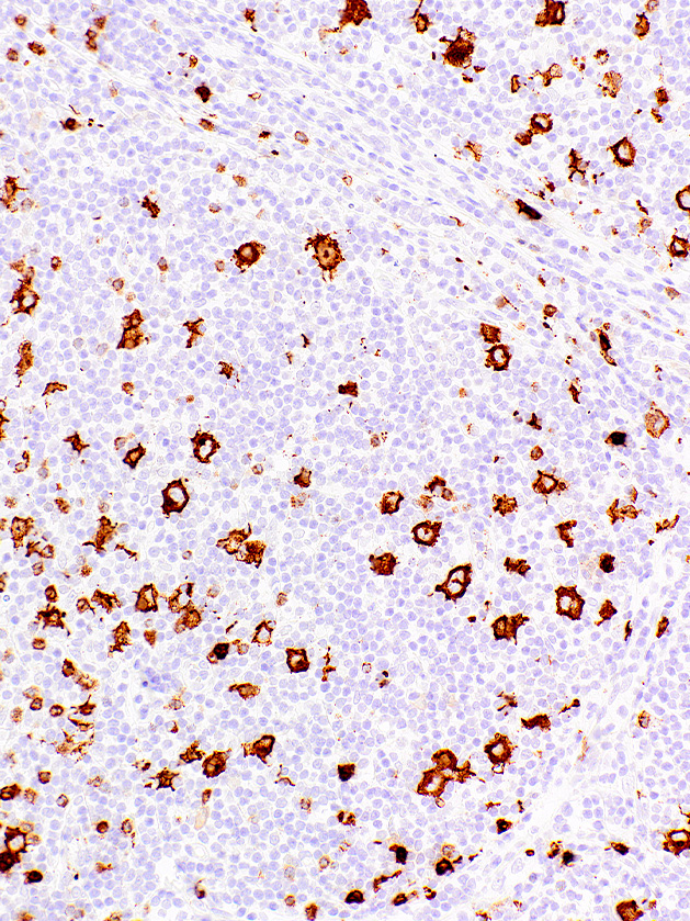 CD15/Leu-M1