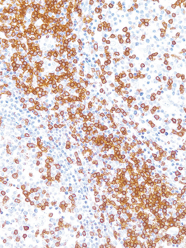 CD3