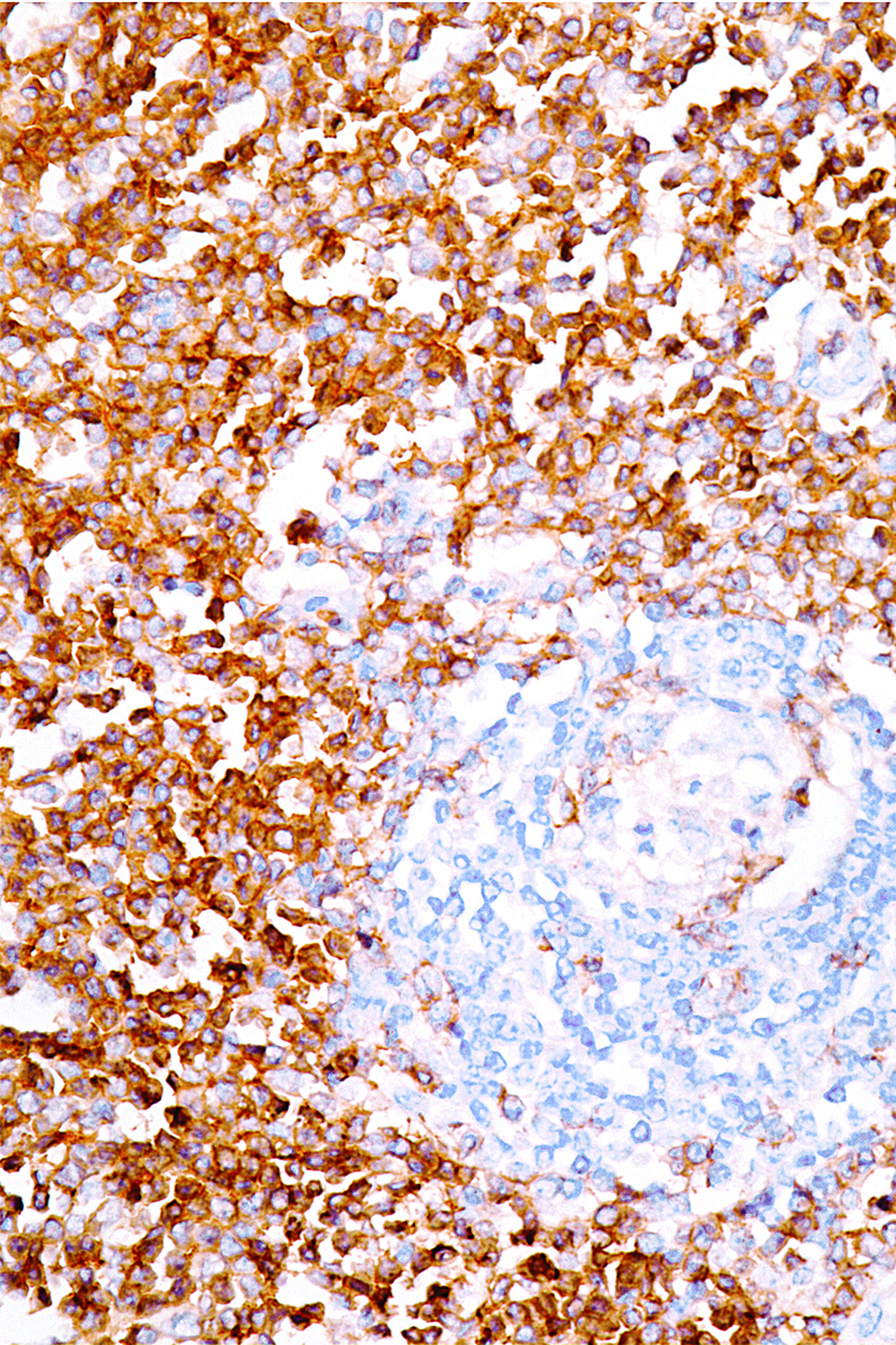 CD4