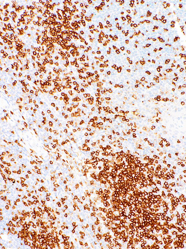 CD45RO