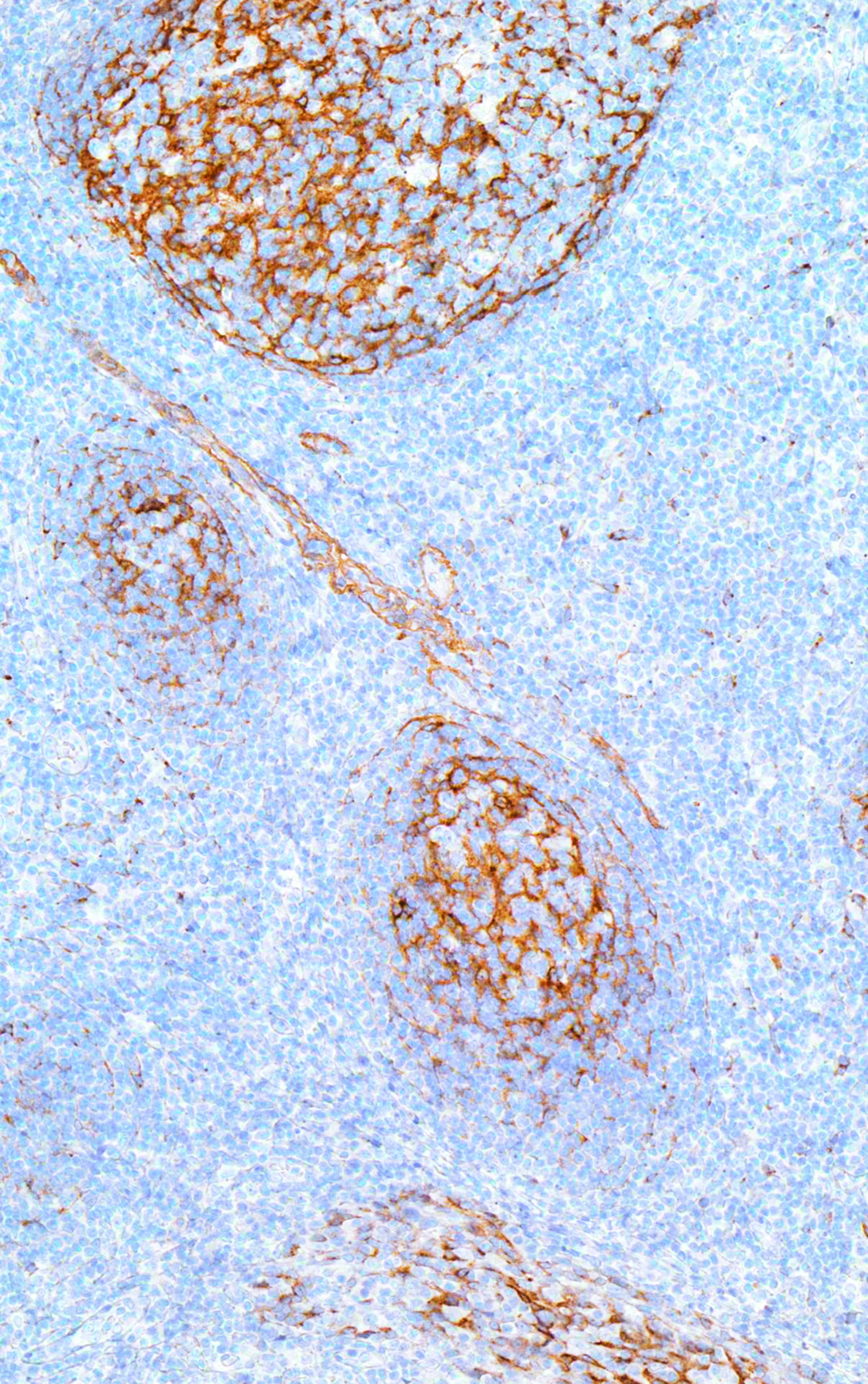 Clusterin/Apolipoprotein J