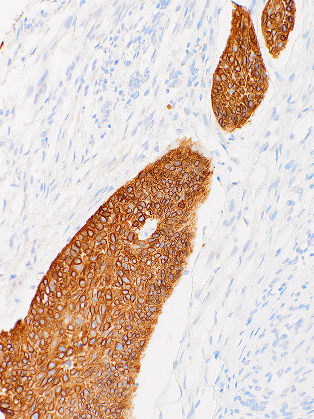 Cytokeratin 14