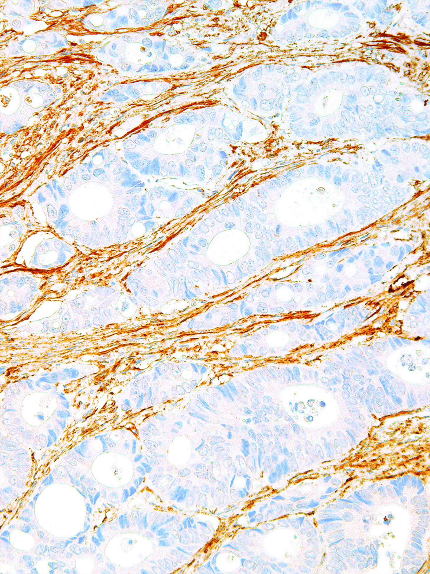 Fibronectin