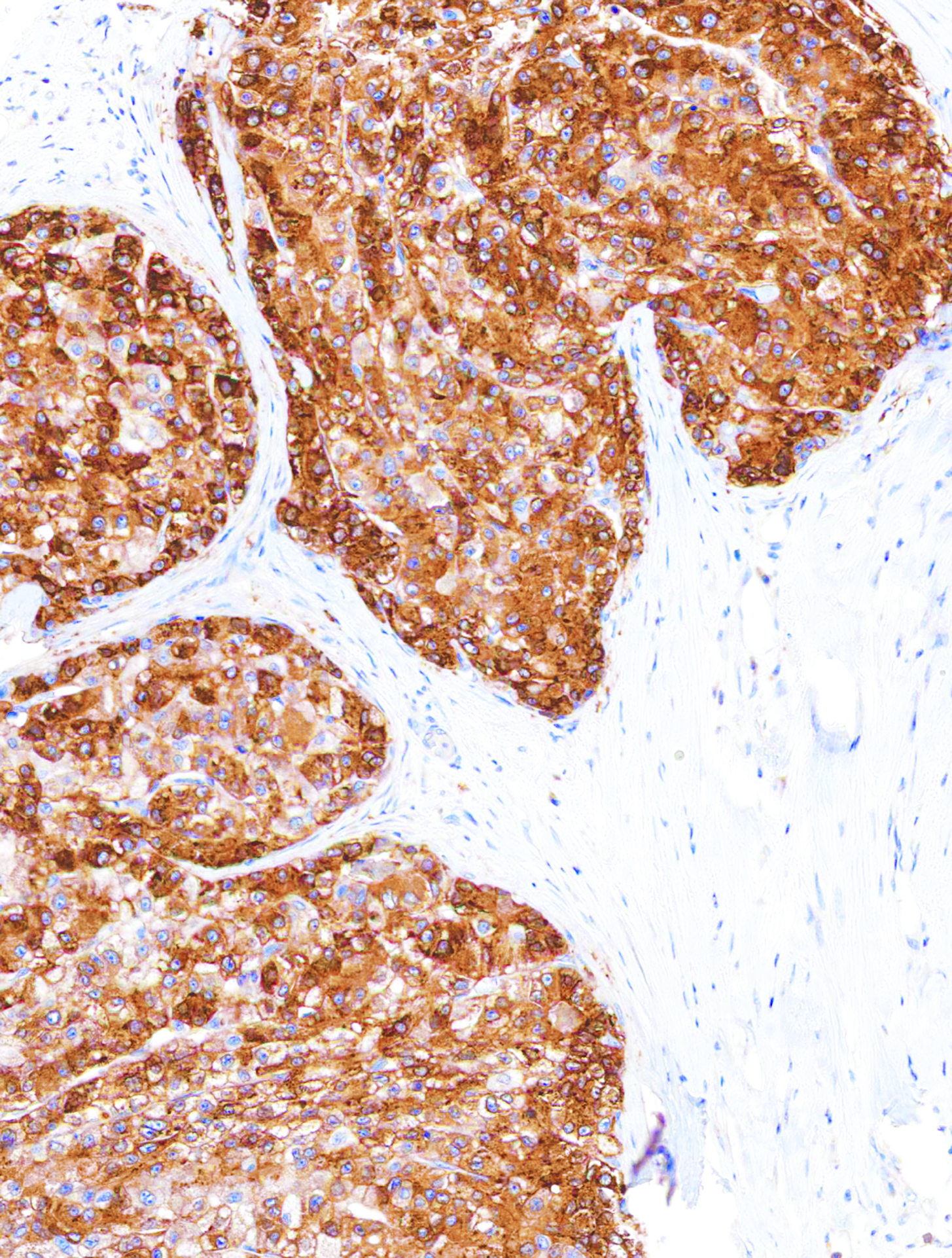 Glutamine Synthetase