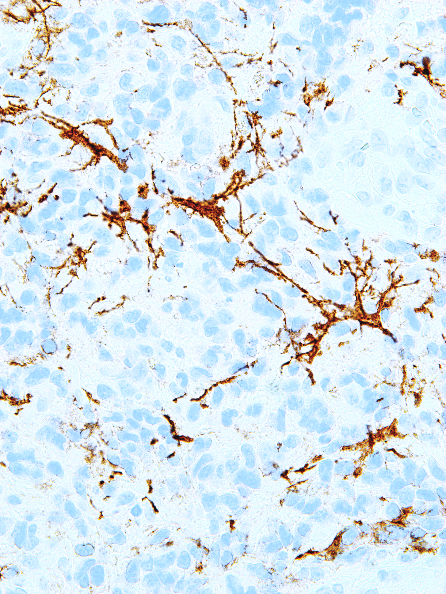 Nerve Growth Factor Receptor (NGFR)