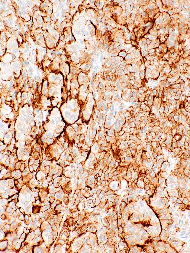 Podoplanin