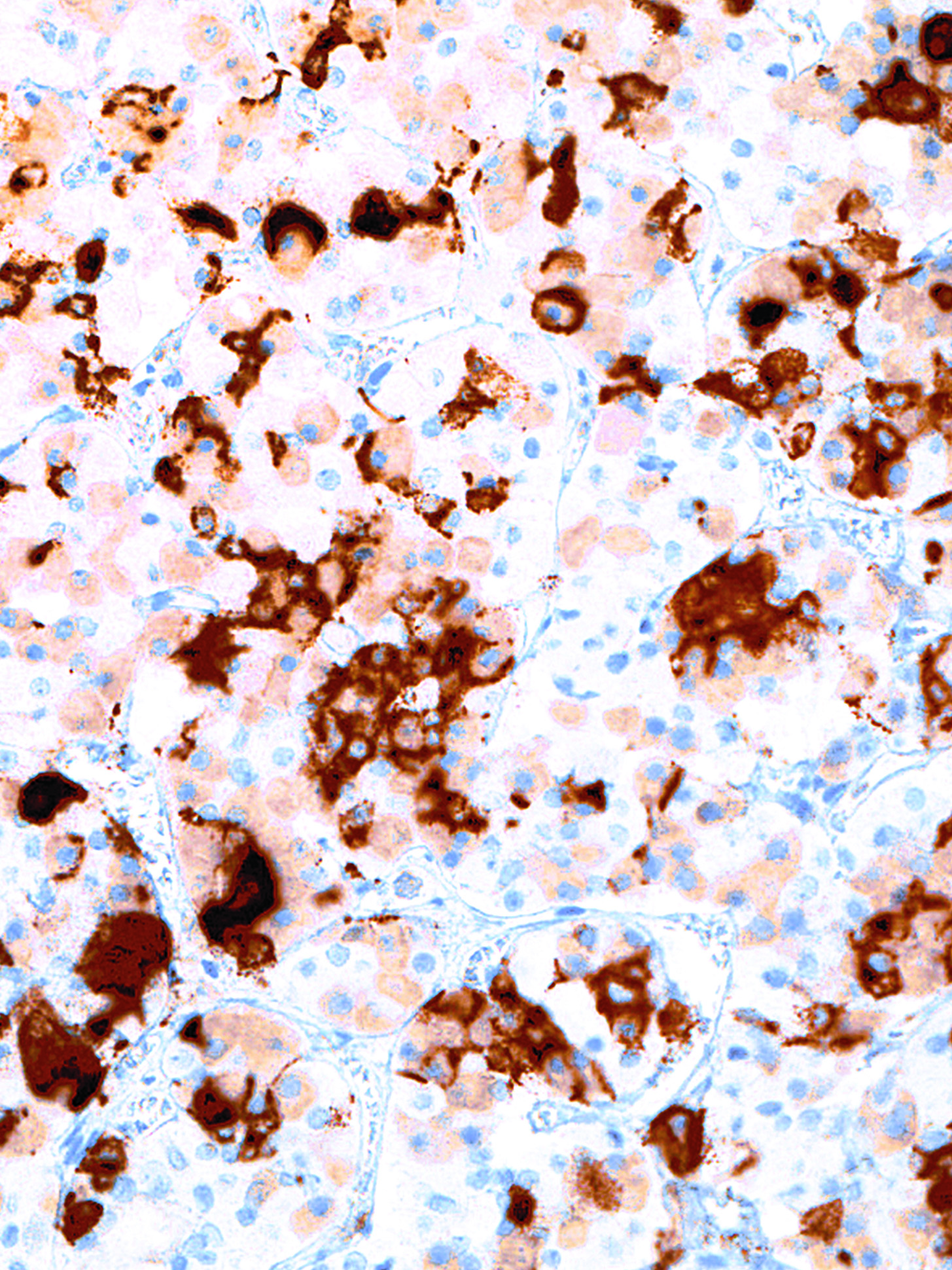 Prolactin