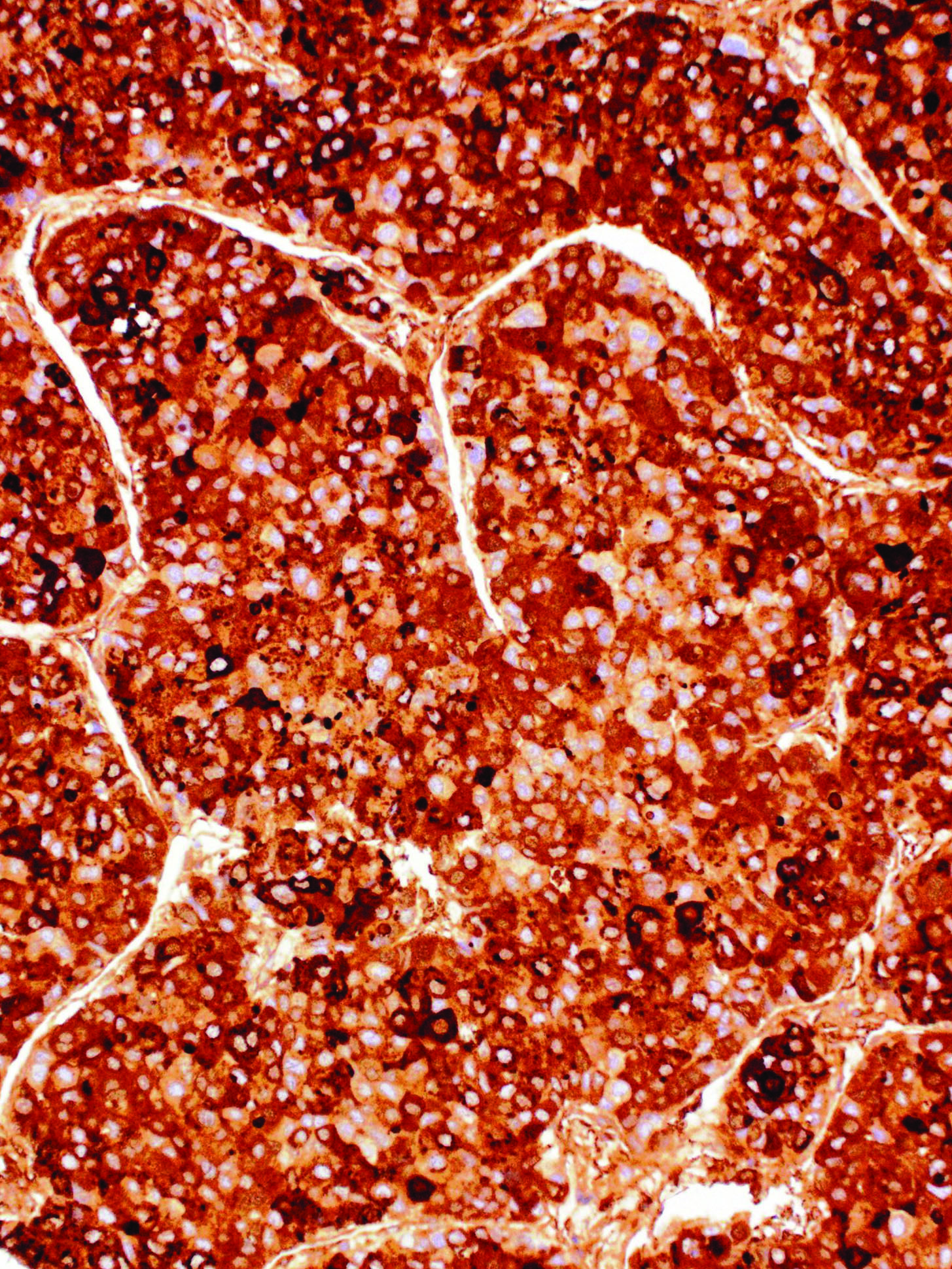 Alpha-Fetoprotein