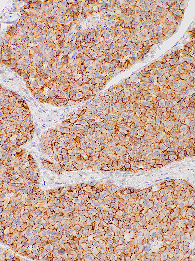 N-cadherin
